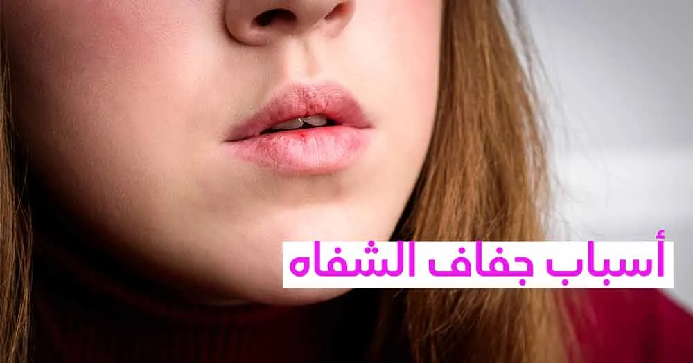 أسباب جفاف الشفاه
